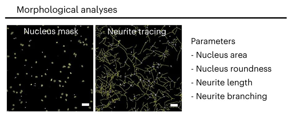 Open access visualization of Microscopy, Automated Analysis, Neuron Morphology, Nuclei Detection Mask, DAPI Channel