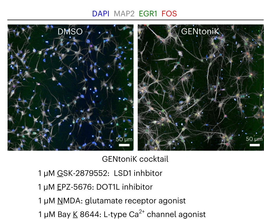 Open access visualization of Microscopy, Cortical Neurons, DMSO, GENtoniK, Representative Images