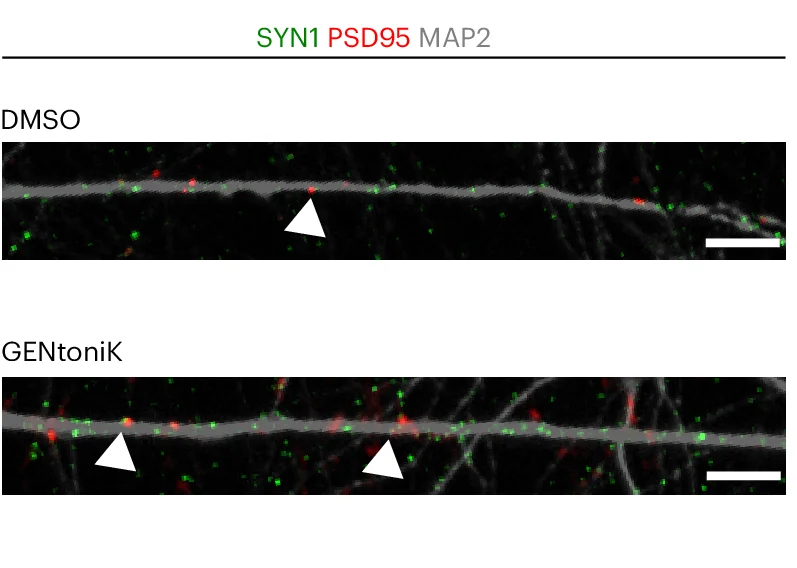 Open access visualization of Microscopy, hPSC Neurons, Synaptic Markers, Structured Illumination Imaging, SYN1
