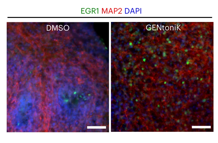 Open access visualization of Microscopy, Immunofluorescence, EGR-1, MAP2, Cortical Organoids