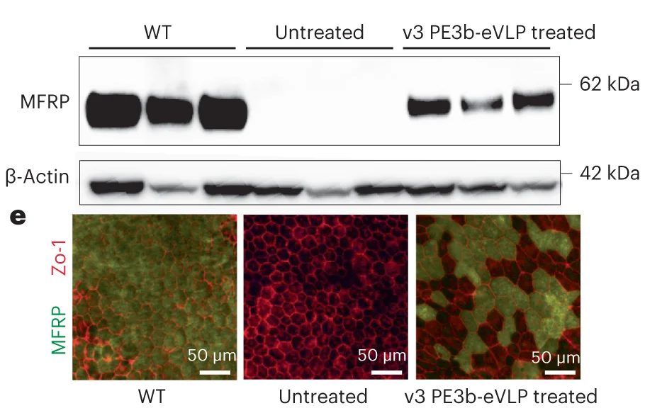 Open access visualization of Gel, Microscopy, Western Blot, RPE Tissue, Protein Extracts