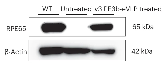 Open access visualization of Gel, Western Blot, RPE Tissue, Protein Extracts, C57BL/6J Mice