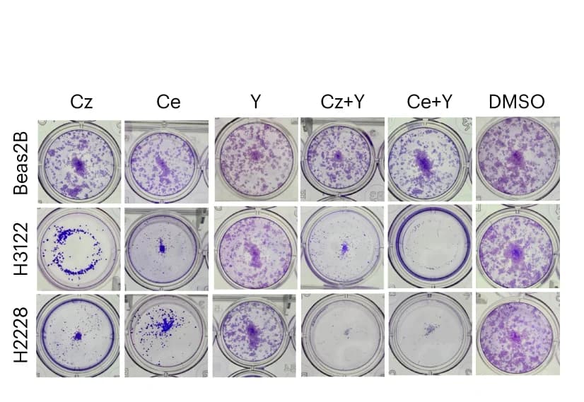 Open access visualization of Microscopy, Inhibitors, Table