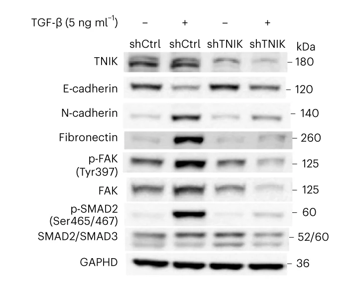 Open access visualization of Gel, Western Blots, E-cadherin, N-cadherin, Fibronectin