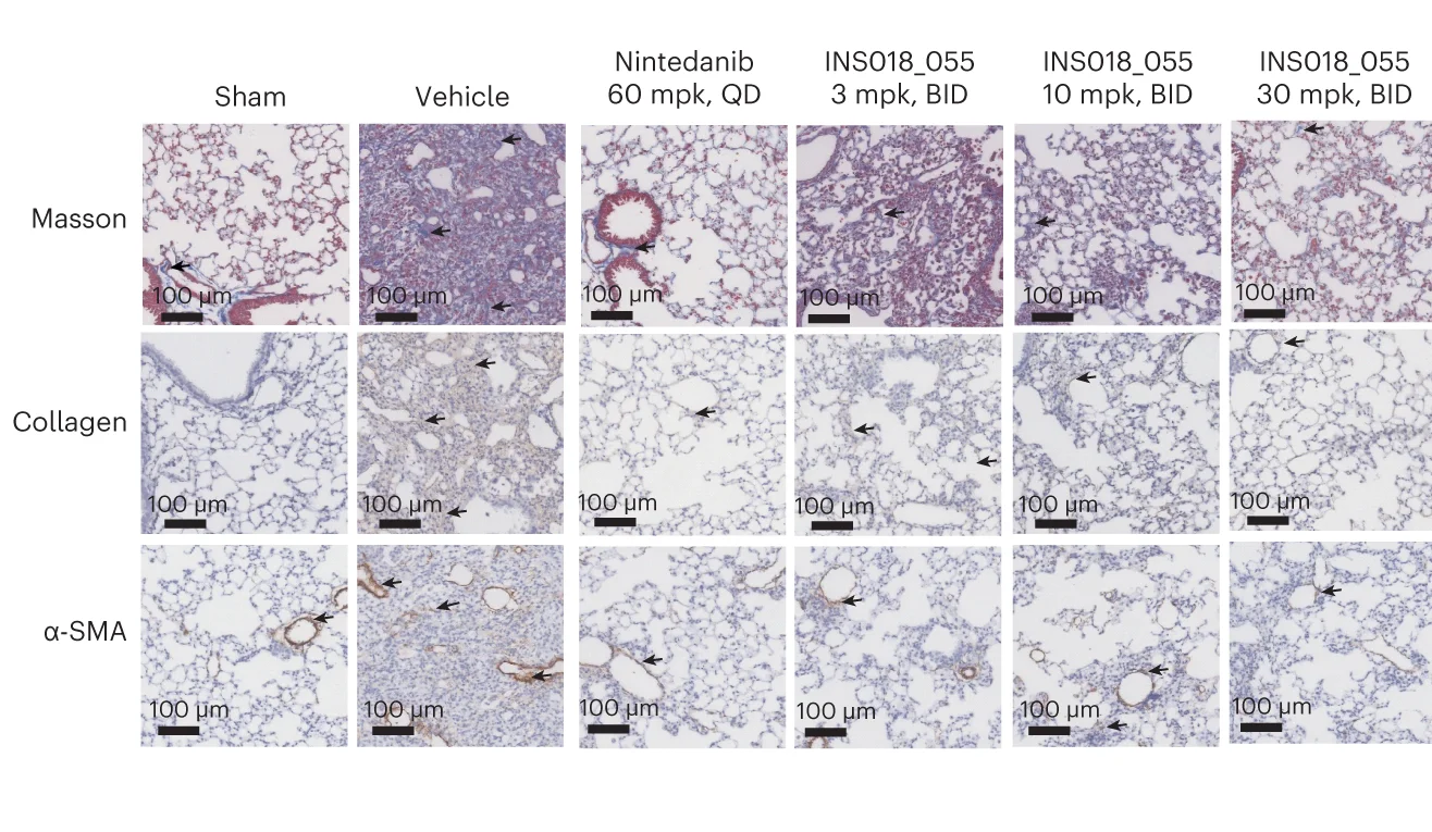 Open access visualization of Microscopy, INS018_055, Nintedanib, Masson's Trichrome Staining, Modified Ashcroft Scores