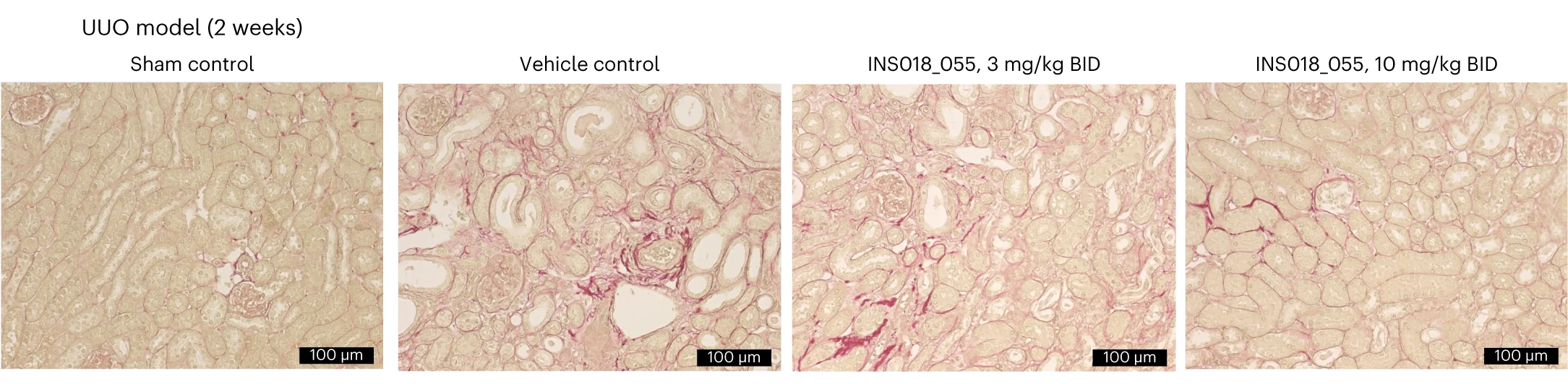 Open access visualization of Microscopy, Sirius Red Staining, Quantitation, Positive Area
