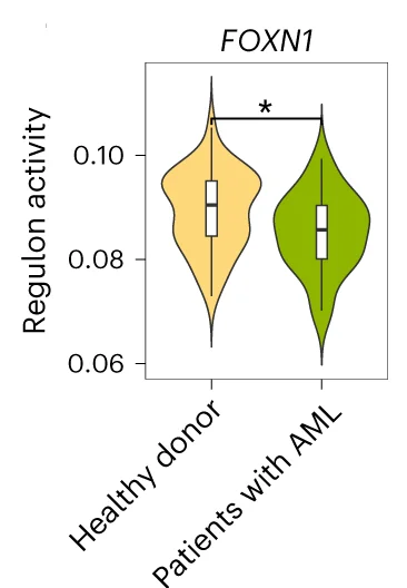 Open access visualization of Violin Plot, Box Plot, FOXN1 Regulon Activity, Healthy Donors, AML Patients