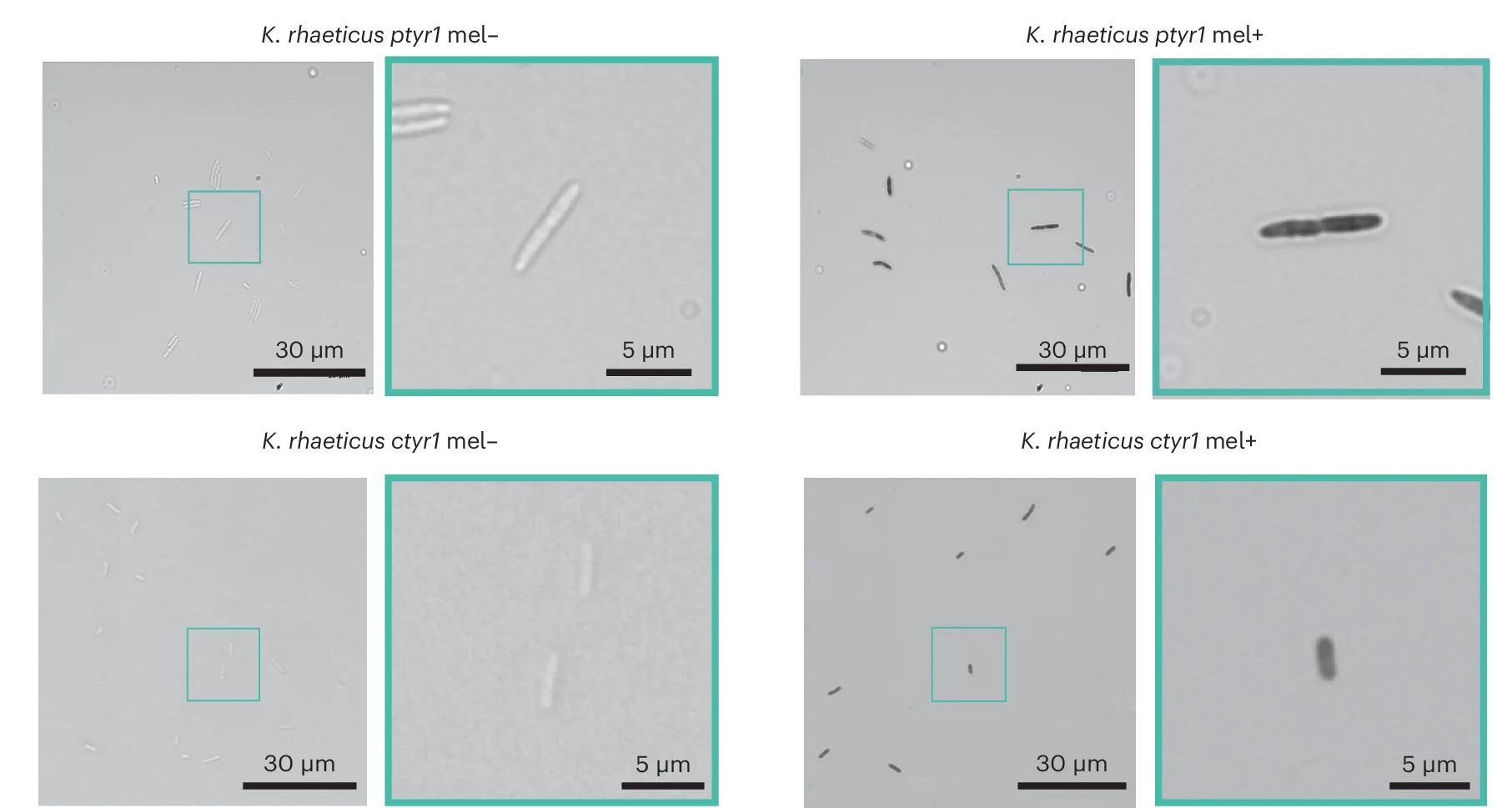 Open access visualization of Microscopy, Optical Microscopy, K. rhaeticus, Melanin Development, Single Cell