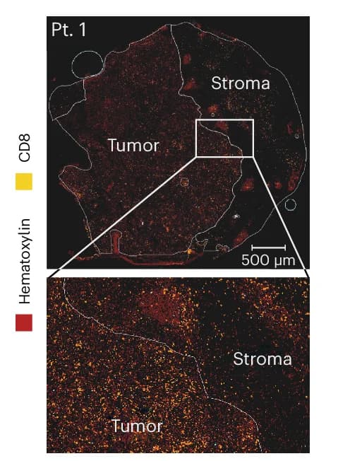 Open access visualization of Microscopy, Immunohistochemistry, Hematoxylin, CD8, Whole-tissue Section