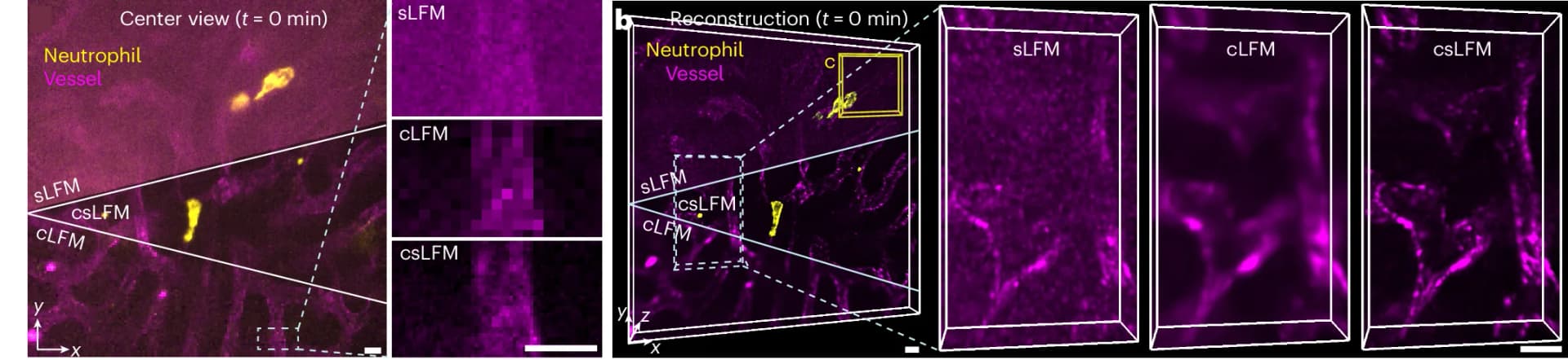 Open access visualization of Microscopy, Neutrophils, Vessels, Mouse Liver, sLFM