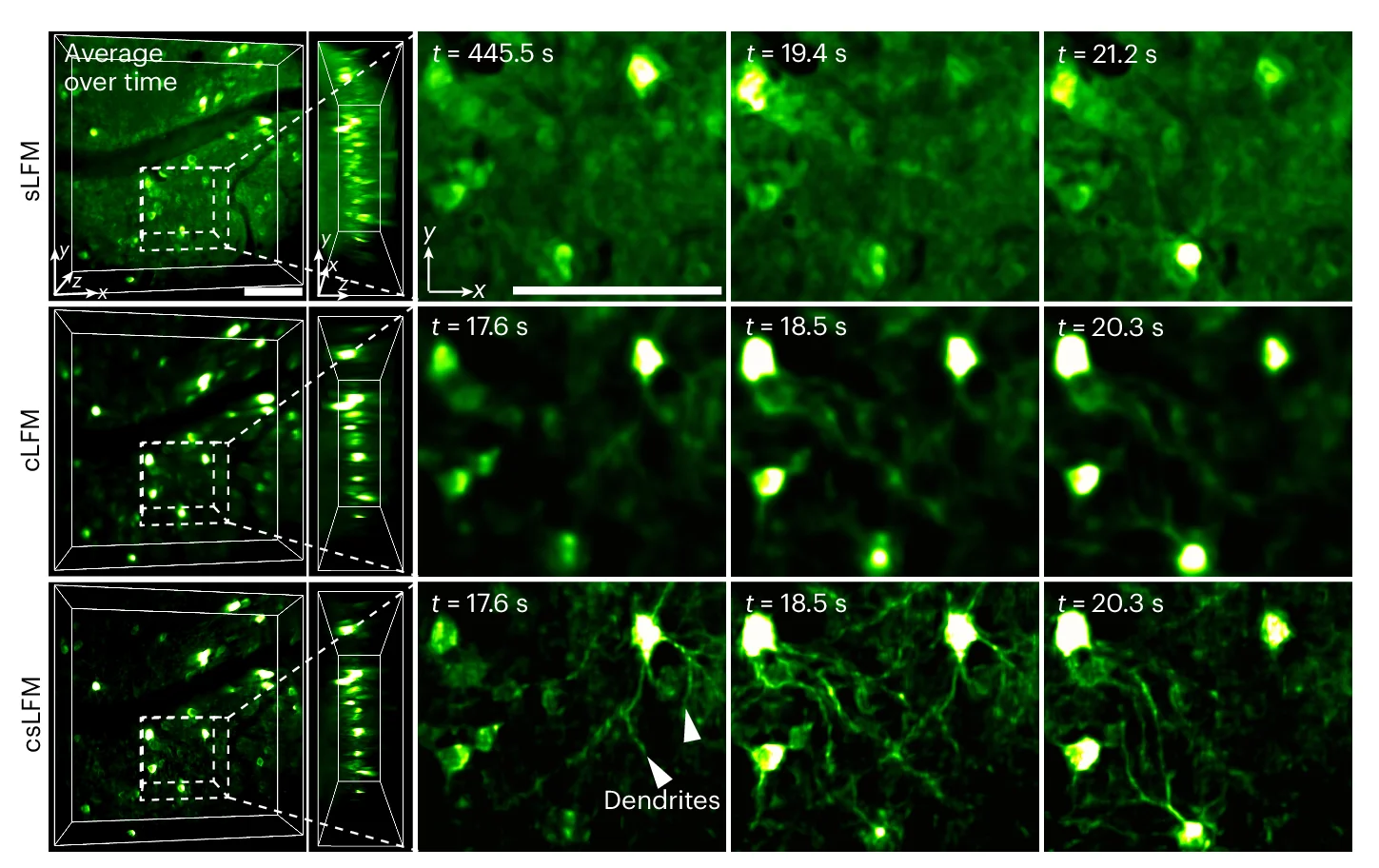 Open access visualization of Microscopy, sLFM, cLFM, csLFM, Mouse Cortex
