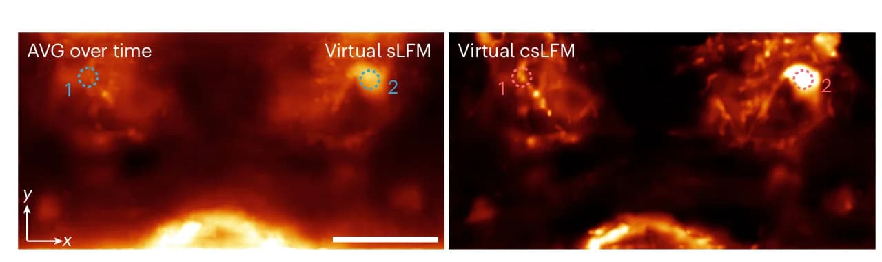 Open access visualization of Microscopy, Dopamine Neurons, Drosophila Brain, Voltage Signals, sLFM