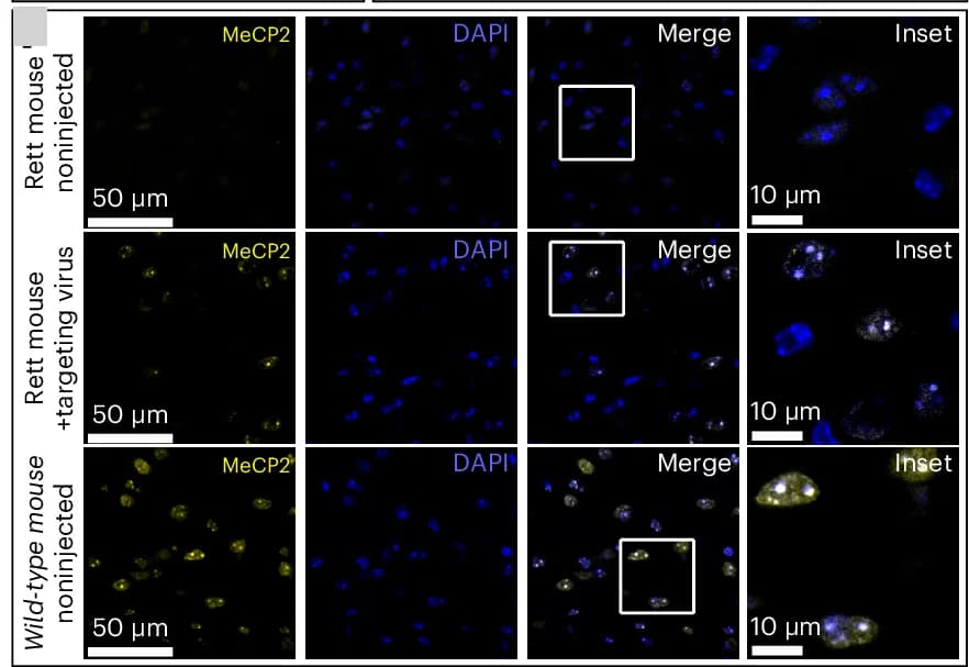Open access visualization of Microscopy, Thalamus Sections, MeCP2, DAPI, Nuclei