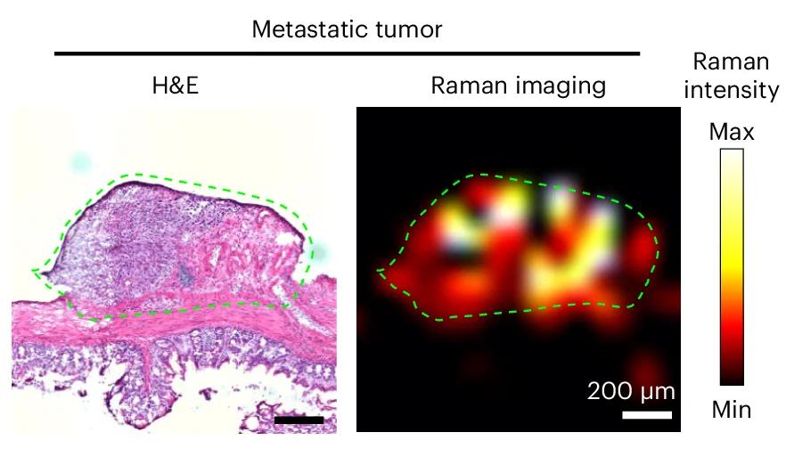 Open access visualization of Microscopy, Heatmap, Histological Analysis, Metastatic Tumor, H&E Staining