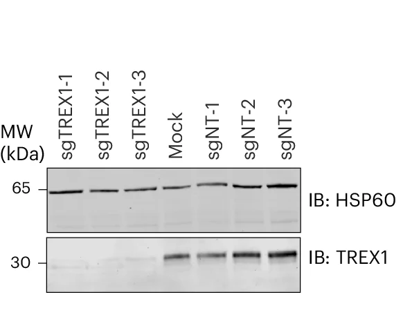 Open access visualization of Gel, Protein Extracts, T Cells, Western Blotting, TREX1