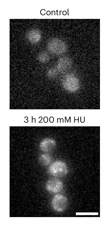 Open access visualization of Microscopy, Fluorescence Micrographs, Yeast Cells, P-body Marker, Dcp2