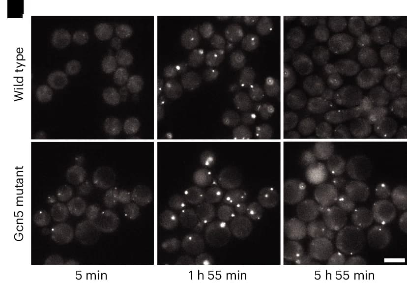 Open access visualization of Microscopy, Fitness Assay, Gcn5 Catalytic Dead Mutant, Wild Type Strain, HU