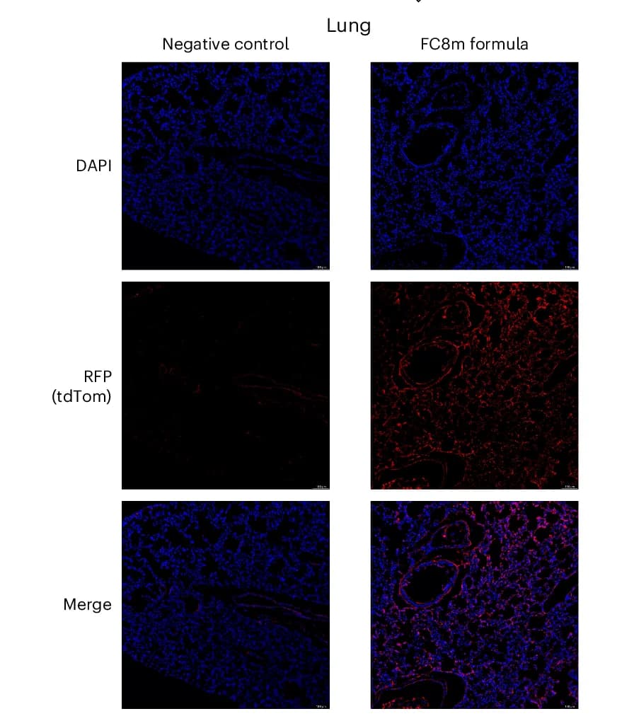 Open access visualization of Microscopy, Nuclear Staining, DAPI, tdTomato, Lung Tissue