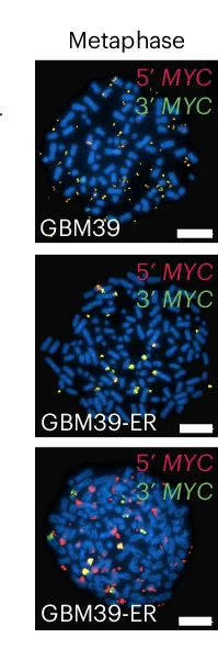 Open access visualization of Microscopy, DNA FISH, MYC Gene, GBM39, GBM39-ER