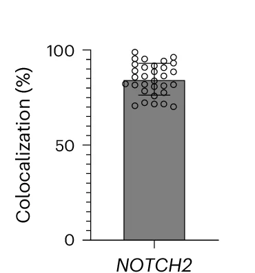 Open access visualization of Bar Plot, Error Bars, Scatter Plot, Colocalization, Csm Complex