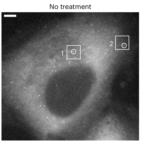 Open access visualization of Microscopy, NOTCH2 mRNAs, U2OS Cell