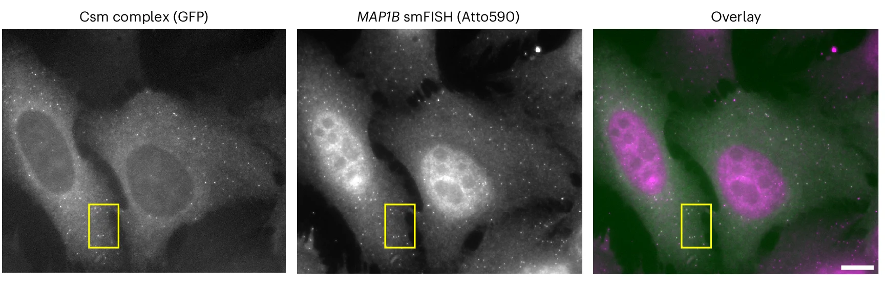 Open access visualization of Microscopy, MAP1B mRNAs, GFP-tagged Csm Complex, smFISH Probes, Fixed-Cell Image
