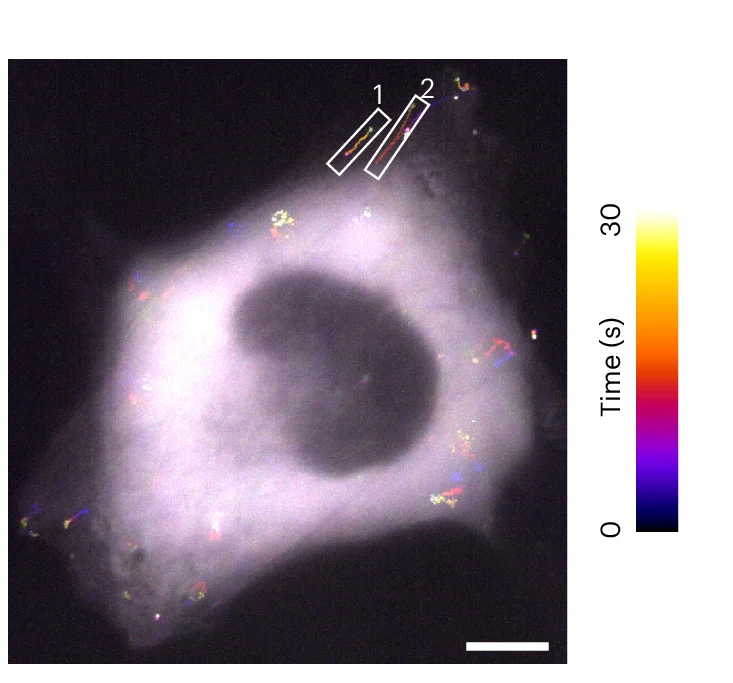 Open access visualization of Microscopy, Temporal Trajectory, MAP1B mRNAs, U2OS Cell, Directional Transport