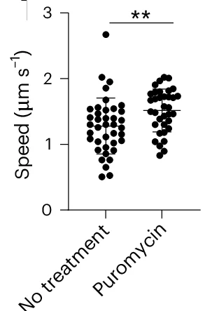 Open access visualization of Scatter Plot, MAP1B mRNA, Directed Movement Speed, Puromycin, Statistical Analysis