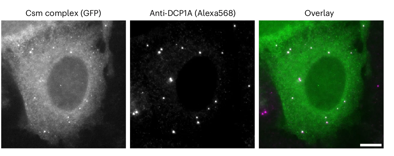 Open access visualization of Microscopy, MAP1B mRNA, GFP-tagged Csm Complex, Puromycin, Immunostaining