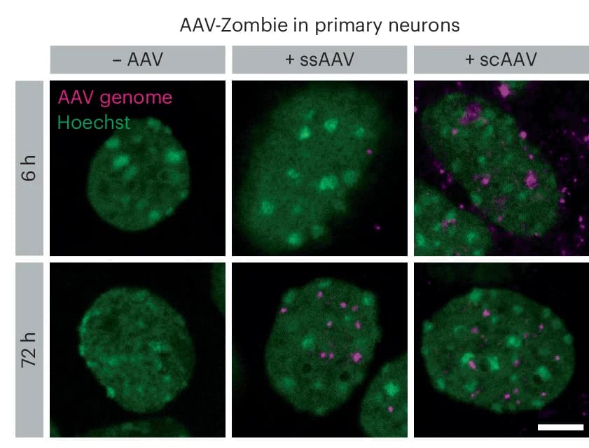 Open access visualization of Microscopy, ssAAV, scAAV, Primary Neurons, Transduction