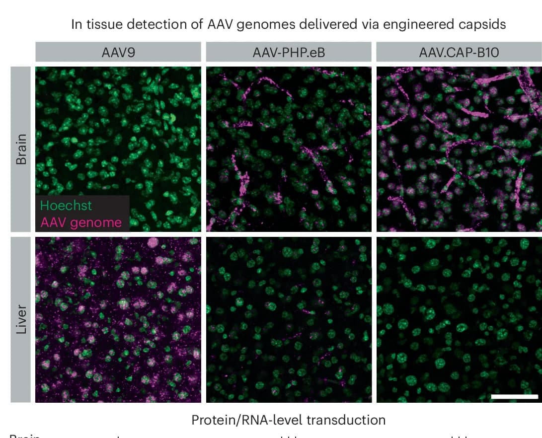Open access visualization of Microscopy, AAV-Zombie, scAAV, C57BL/6J Mouse, Brain