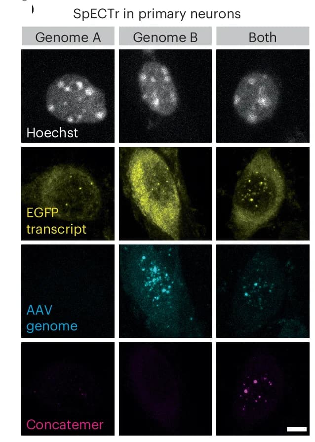 Open access visualization of Microscopy, SpECTr, Primary Neurons, Transduction