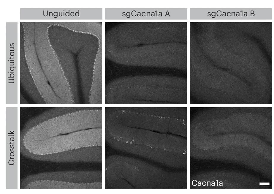 Open access visualization of Microscopy, IHC, Cacna1a, Cerebellum