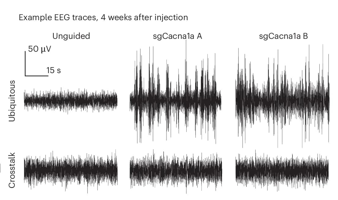 Open access visualization of Line Plot, Epileptic activity, Cortex, EEG