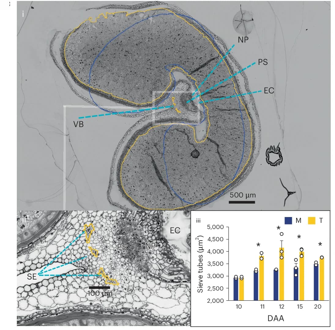 Open access visualization of Microscopy, Bar Plot, Bar, Transverse Section, Grain