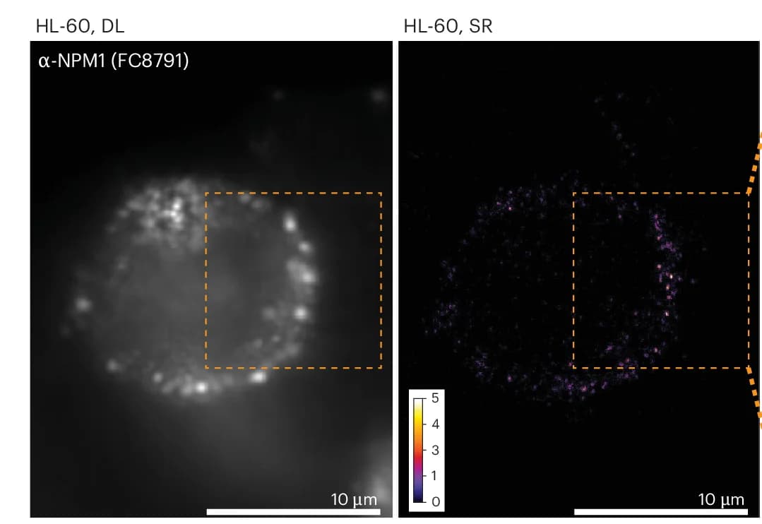 Open access visualization of Microscopy, HL-60 Cells, NPM1, Diffraction-Limited Widefield Microscopy, SR Reconstructions
