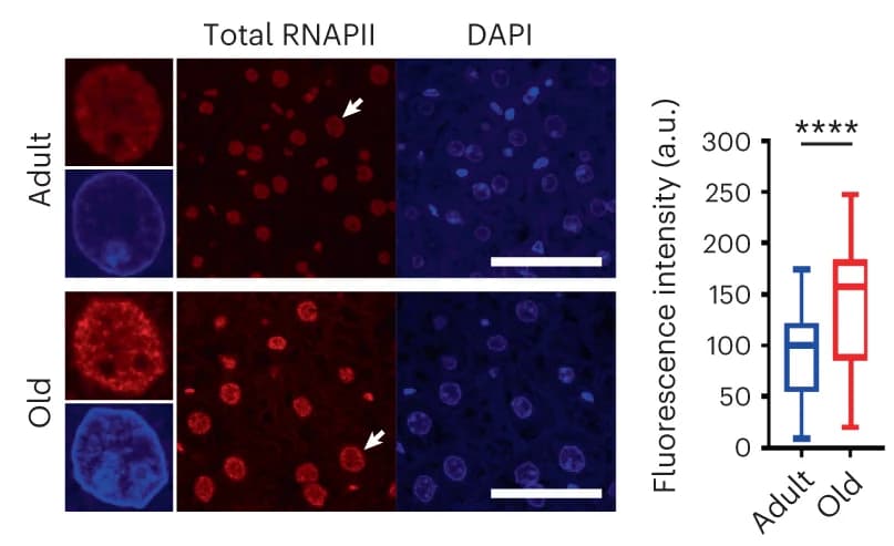 Open access visualization of Box Plot, Microscopy, Total RNAPII, Immunofluorescence staining, Hepatocytes