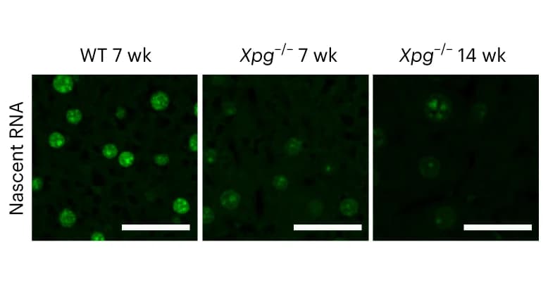 Open access visualization of Microscopy, Photo, EU-labeled nascent RNA, Liver nuclei, Xpg -/- mice