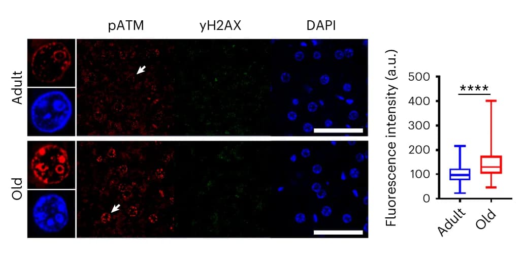 Open access visualization of Box Plot, Microscopy, Phosphorylated ATM, γH2A.X, Adult mouse liver