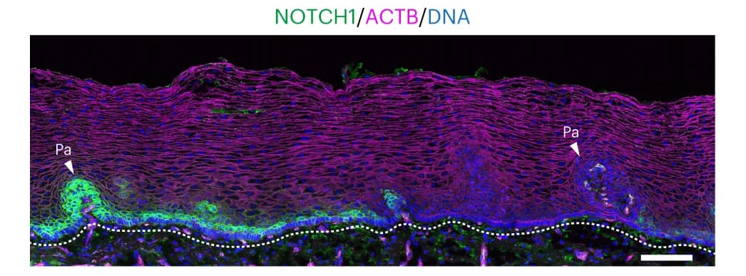 Open access visualization of Microscopy, Esophagus, NOTCH1, F-actin, Papillae