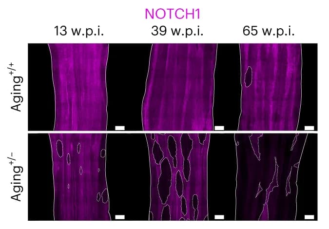 Open access visualization of Microscopy, NOTCH1 staining, Esophageal epithelium, Aging, YFPCreNotch1 +/+