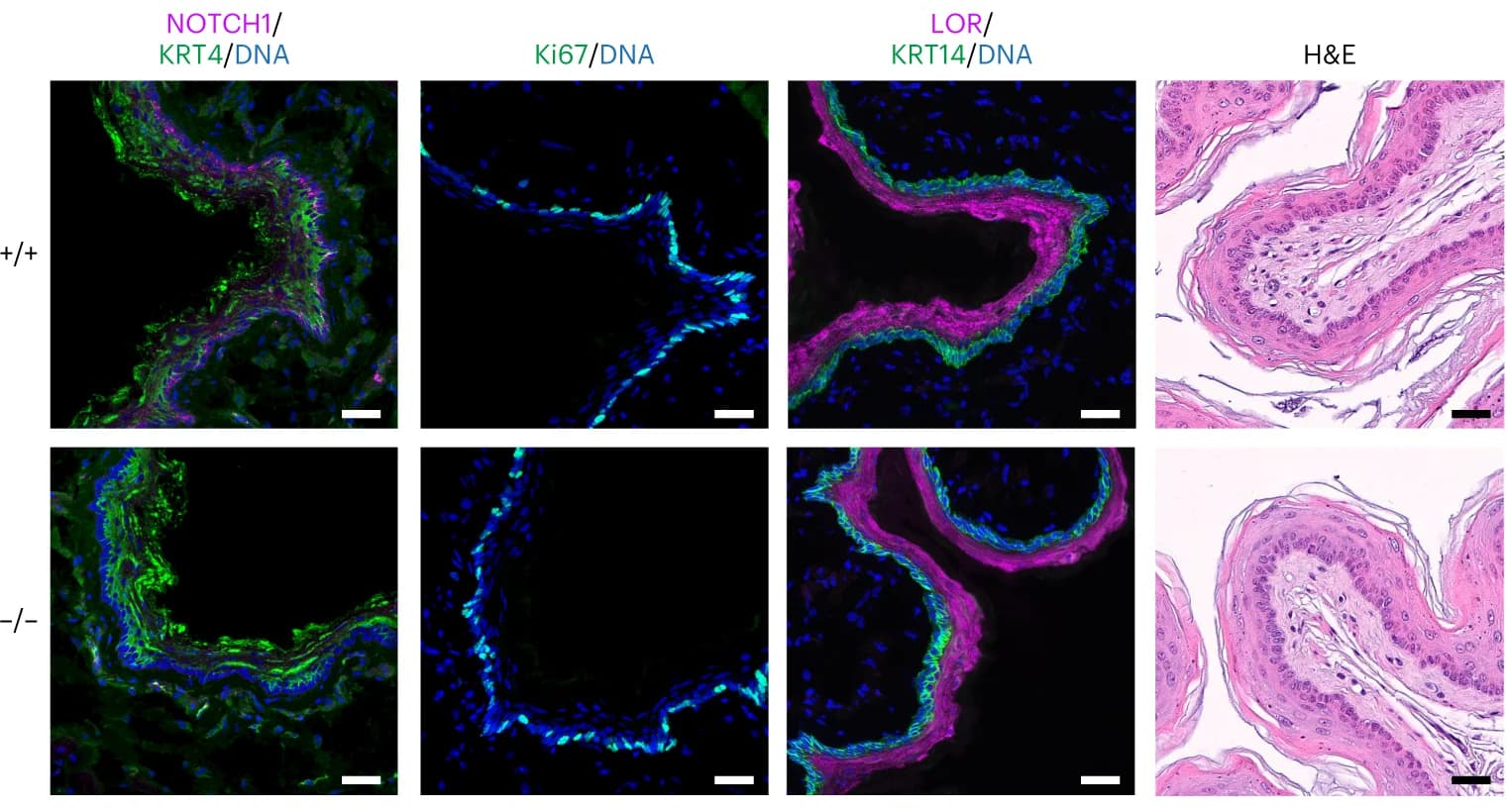 Open access visualization of Microscopy, Photo, YFPCreNotch1 flox/flox Mice, Esophageal Epithelium, Basal Cell Marker KRT14