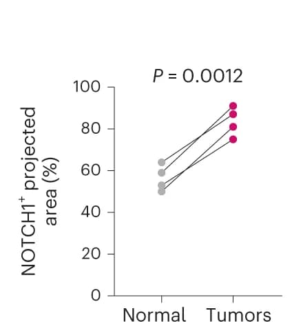 Open access visualization of Line Plot, Scatter Plot, NOTCH1 staining, Epithelium, Tumors