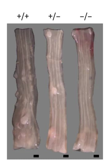Open access visualization of Photo, Esophagus, Genotype, Images