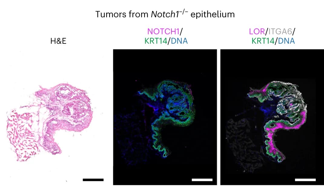 Open access visualization of Microscopy, Tumor, Notch1 -/- Epithelium, H&E Staining, Keratin 14