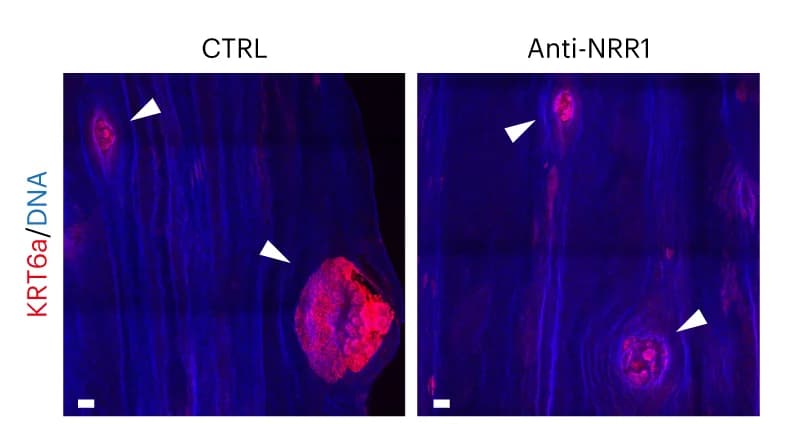 Open access visualization of Microscopy, Tumor, KRT6a Staining, Esophageal Epithelium, Control Mice