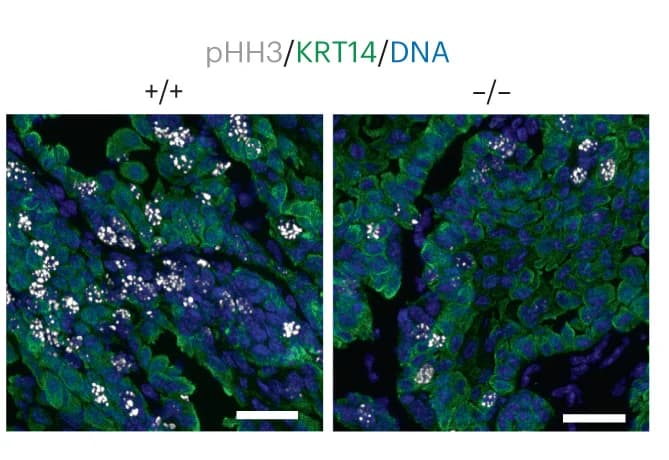 Open access visualization of Microscopy, Tumors, Esophagus, KRT14, pHH3