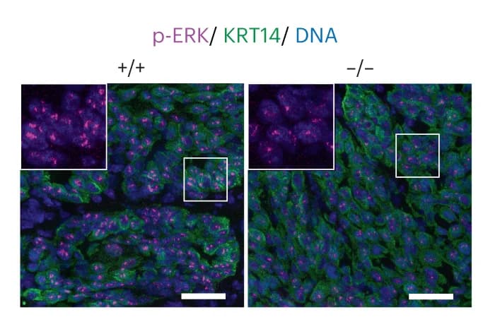 Open access visualization of Microscopy, Tumors, Esophagi, KRT14, Phospho-ERK1/ERK2