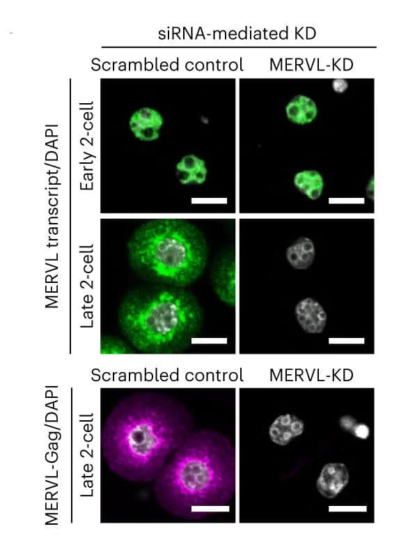 Open access visualization of Microscopy, smFISH, MERVL RNA, DAPI, Control Embryos