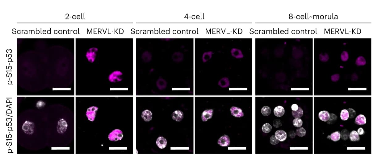 Open access visualization of Microscopy, Photo, Immunofluorescence Staining, Phosphorylated p53, Embryos